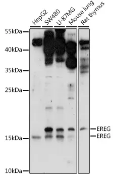 EREG Rabbit Polyclonal Antibody - image 1
