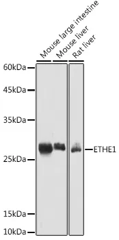 ETHE1 Rabbit Polyclonal Antibody - image 1