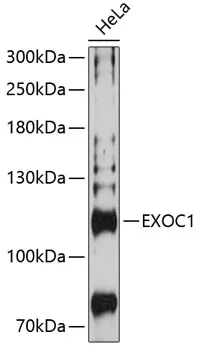 EXOC1 Rabbit Polyclonal Antibody - image 1