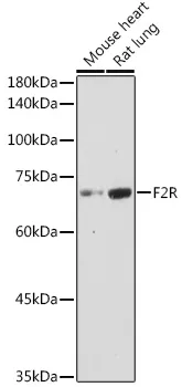 Thrombin Receptor (F2R) Rabbit Polyclonal Antibody - image 1