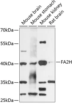FA2H Rabbit Polyclonal Antibody - image 1