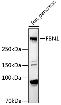 Fibrillin 1 (FBN1) Rabbit Polyclonal Antibody - image 1