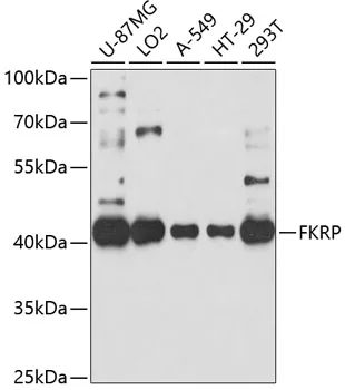 FKRP Rabbit Polyclonal Antibody - image 1