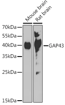 GAP43 Rabbit Polyclonal Antibody - image 1