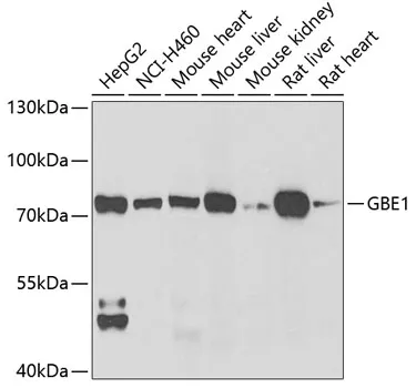GBE1 Rabbit Polyclonal Antibody - image 1