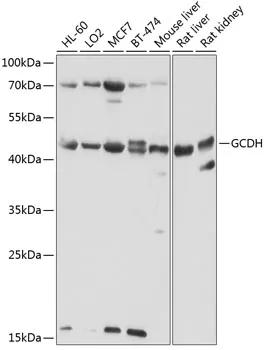 GCDH Rabbit Polyclonal Antibody - image 1