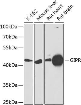 Gastric Inhibitory Polypeptide Receptor (GIPR) Rabbit Polyclonal Antibody - image 1
