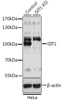GIT1 Rabbit Polyclonal Antibody - image 1
