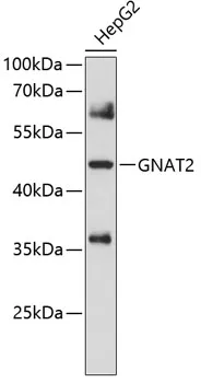 GNAT2 Rabbit Polyclonal Antibody - image 1