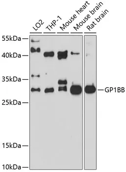 CD42c (GP1BB) Rabbit Polyclonal Antibody - image 1