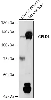 GPLD1 Rabbit Polyclonal Antibody - image 1
