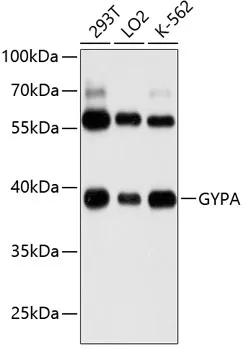 Glycophorin A (GYPA) Rabbit Polyclonal Antibody - image 1