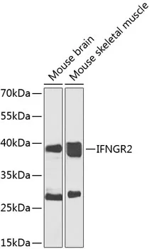 IFNGR2 Rabbit Polyclonal Antibody - image 1