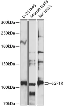 IGF1 Receptor (IGF1R) Rabbit Polyclonal Antibody - image 1