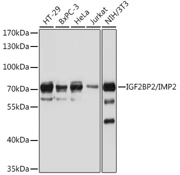 IGF2BP2 Rabbit Polyclonal Antibody - image 1