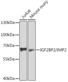 IGF2BP2 Rabbit Polyclonal Antibody - image 1