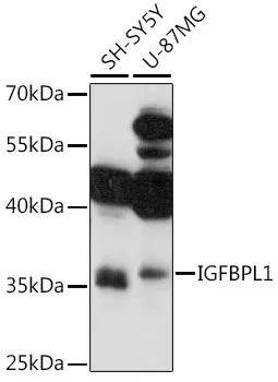 IGFBPL1 Rabbit Polyclonal Antibody - image 1