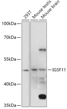 IGSF11 Rabbit Polyclonal Antibody - image 1