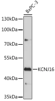 KIR5.1 (KCNJ16) Rabbit Polyclonal Antibody - image 1