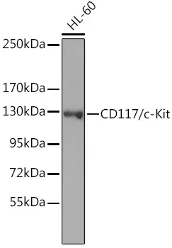 CD117 Rabbit Polyclonal Antibody - image 1