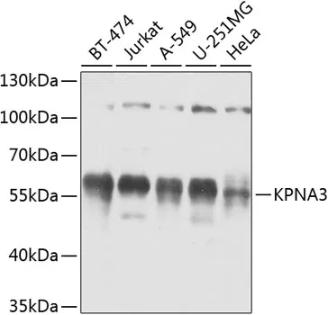 KPNA3 Rabbit Polyclonal Antibody - image 1