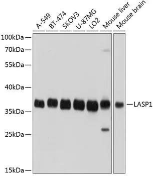 LASP1 Rabbit Polyclonal Antibody - image 1