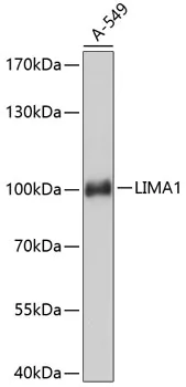 EPLIN (LIMA1) Rabbit Polyclonal Antibody - image 1