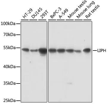 LIPH Rabbit Polyclonal Antibody - image 1