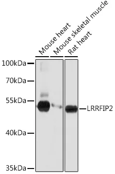 LRRFIP2 Rabbit Polyclonal Antibody - image 1