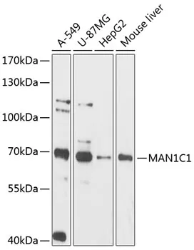 MAN1C1 Rabbit Polyclonal Antibody - image 1