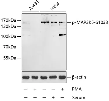 ASK1 (MAP3K5) Rabbit Polyclonal Antibody - image 1