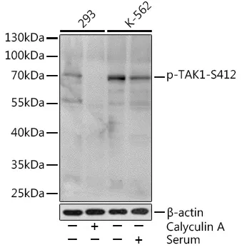 TAK1 (MAP3K7) Rabbit Polyclonal Antibody - image 1
