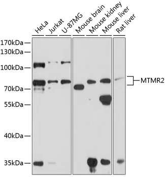 MTMR2 Rabbit Polyclonal Antibody - image 1