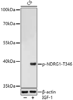 NDRG1 Rabbit Polyclonal Antibody - image 1