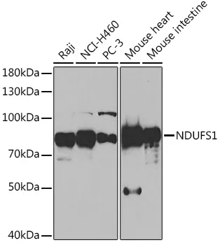NDUFS1 Rabbit Polyclonal Antibody - image 1