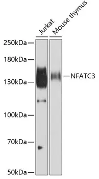 NFAT4 (NFATC3) Rabbit Polyclonal Antibody - image 1