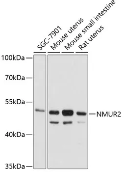 NMUR2 Rabbit Polyclonal Antibody - image 1