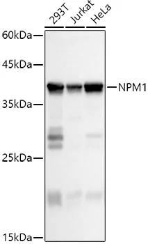 Nucleophosmin (NPM1) Rabbit Polyclonal Antibody - image 1