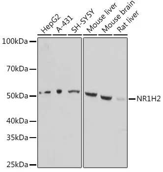 LXR beta (NR1H2) Rabbit Polyclonal Antibody - image 1