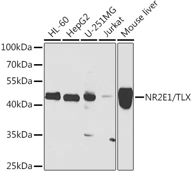 NR2E1 Rabbit Polyclonal Antibody - image 1