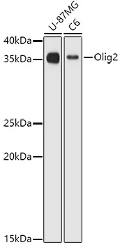 OLIG2 Rabbit Polyclonal Antibody - image 1