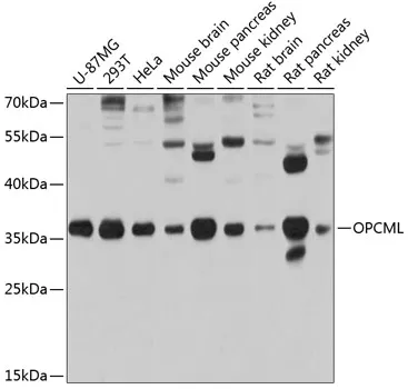 OPCML Rabbit Polyclonal Antibody - image 1