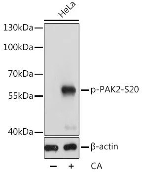PAK2 Rabbit Polyclonal Antibody - image 1