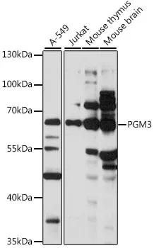 PGM3 Rabbit Polyclonal Antibody - image 1