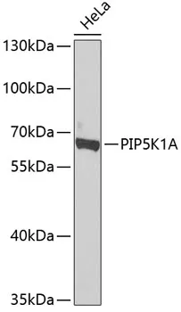 PIP5K1 alpha (PIP5K1A) Rabbit Polyclonal Antibody - image 1