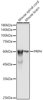Peripherin (PRPH) Rabbit Polyclonal Antibody - image 1