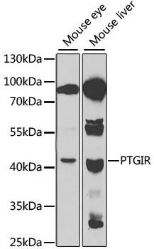 Prostaglandin I2 Receptor (PTGIR) Rabbit Polyclonal Antibody - image 1