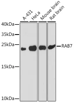 RAB7 (RAB7A) Rabbit Polyclonal Antibody - image 1