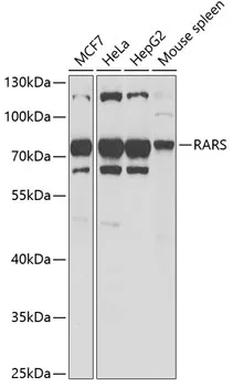 Arginyl tRNA synthetase (RARS) Rabbit Polyclonal Antibody - image 1