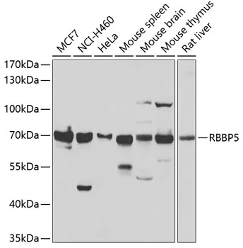 RBBP5 Rabbit Polyclonal Antibody - image 1